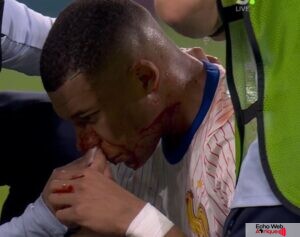 Kylian Mbappé : Le gardien de l’Autriche s’en prend au joueur après sa blessure !