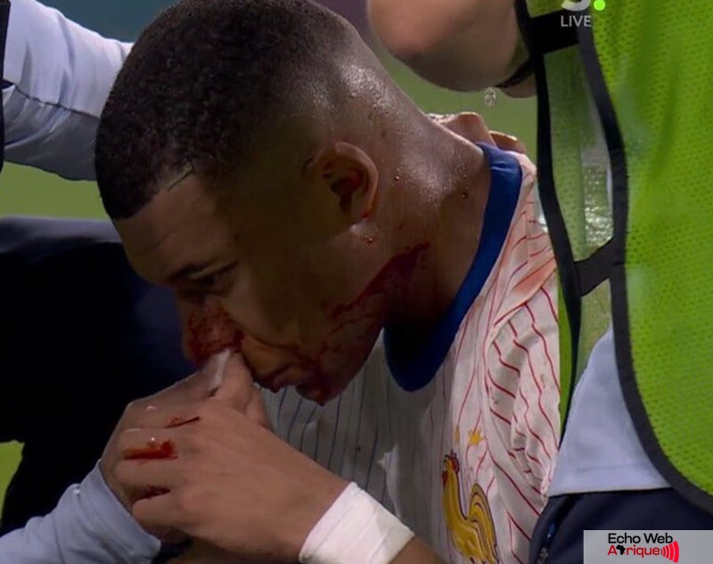 Kylian Mbappé : Le gardien de l’Autriche s'en prend au joueur après sa blessure !