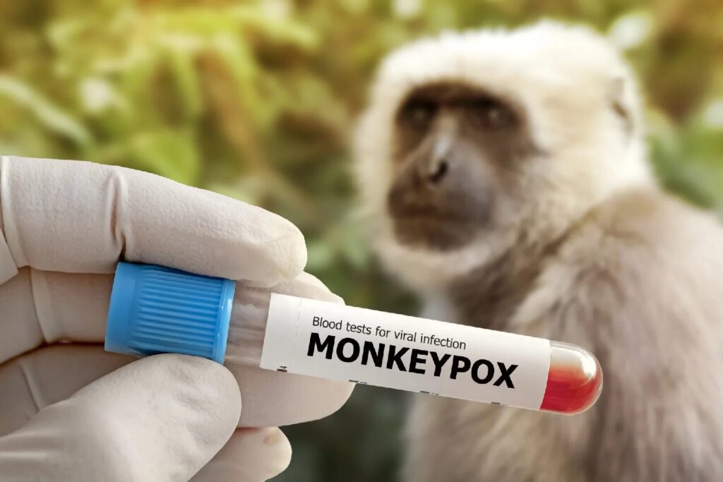 La RDC anticipe sa campagne de vaccination contre la Variole du singe